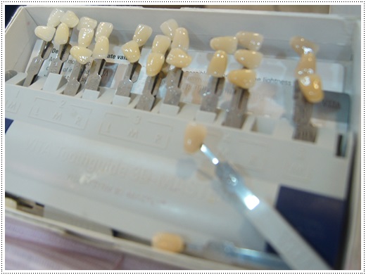 【高雄美白牙齒】推薦到高雄牙醫診所做冷光美白牙齒，快速又方便，終於有一口白淨的牙齒了！