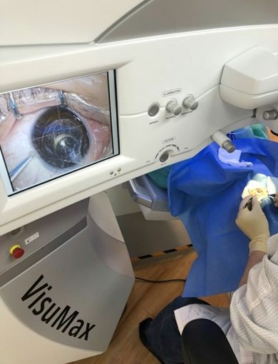 利害來著的近視雷射手術～台北要矯正近視找這位眼科權威就對囉～擺脫眼鏡，讓眼睛恢復健康～價錢、手術推薦
