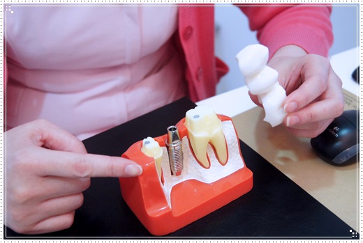 【台中植牙價格分享】查詢台中植牙診所分期推薦牙醫,在信任的牙醫診所植牙真的超有保障~