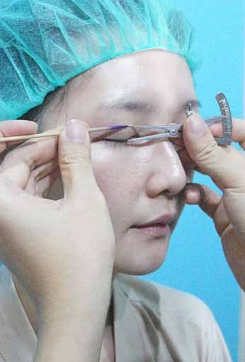 【台北縫雙眼皮診所】台北整形外科診所縫雙眼皮整型手術推薦～好滿意在台北醫美診所做的雙眼皮手術，真的好自然又好有神唷～～