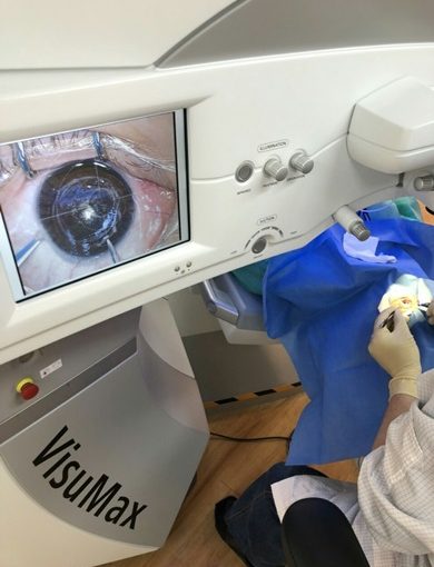 【眼科醫師】最新微創技術，恢復不怕乾眼!網紅指定台北權威，多年手術經驗!